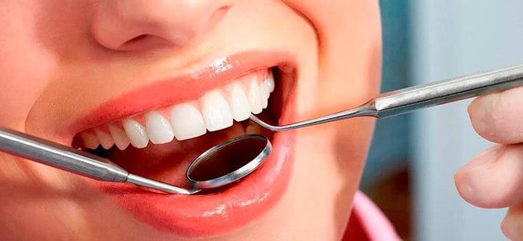 Полная диагностика зубов и план лечения – БЕСПЛАТНО!