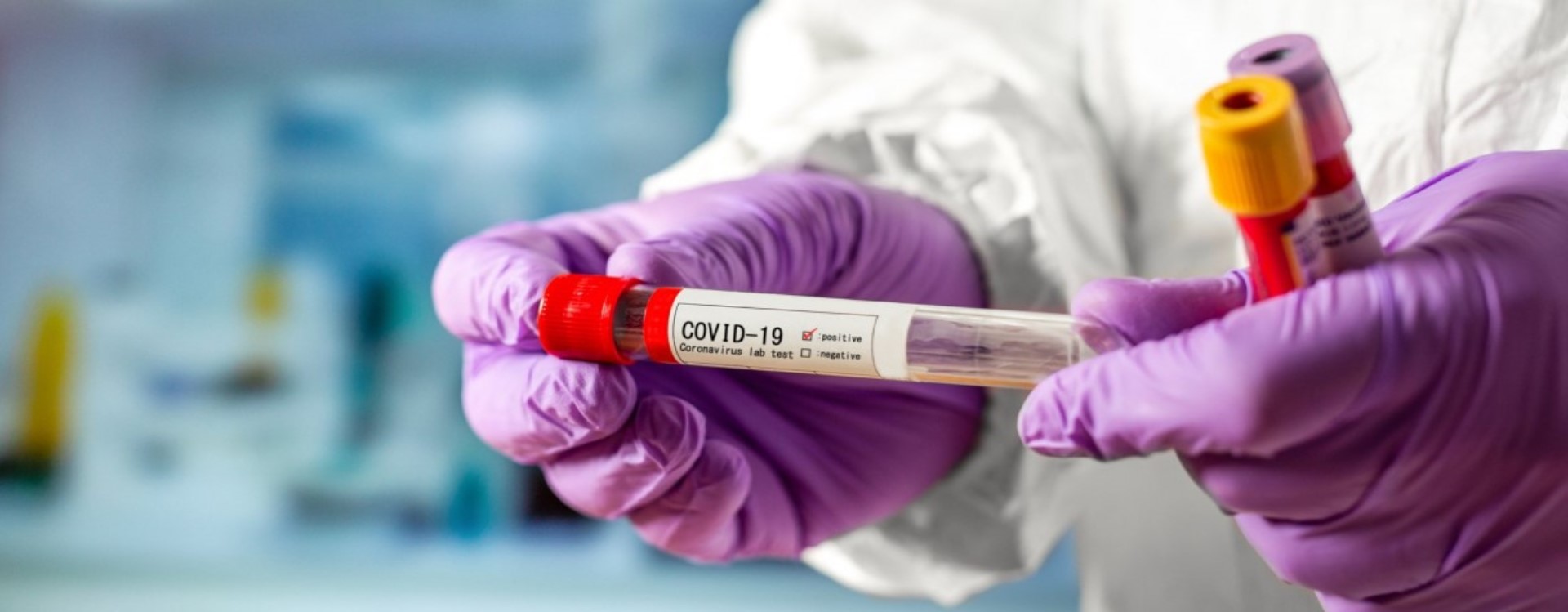 Экспресс-анализ на коронавирус (COVID-19)