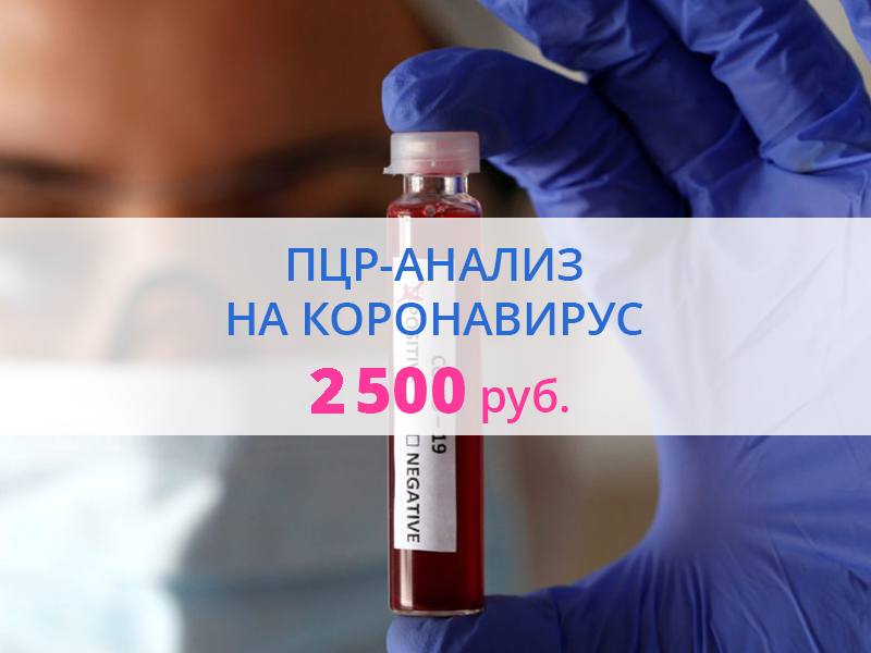 ПЦР-анализ на коронавирус всего за 2500 рублей!