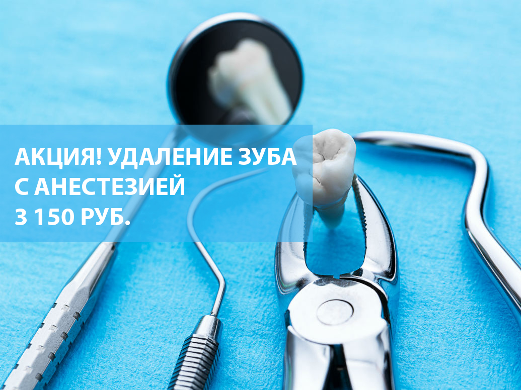 Акция! Удаление зуба с анестезией 3150 рублей!