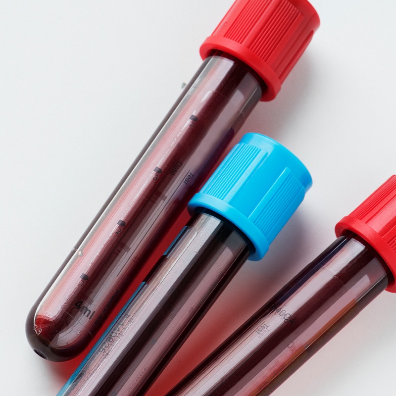 CHECK-UP № 1 - Биохимический анализ крови